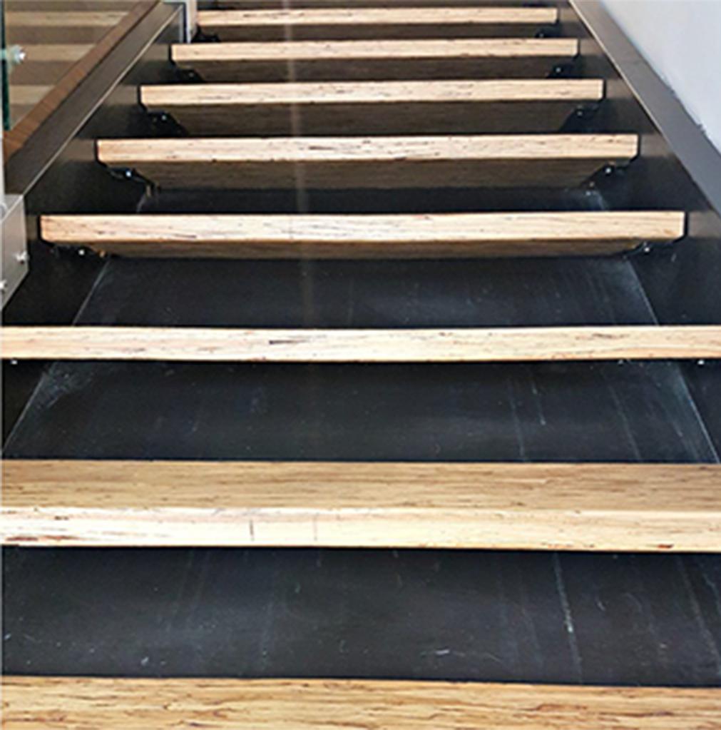 How Dental Bonding Can Improve Your Smile