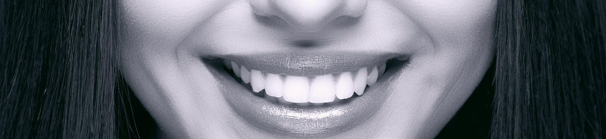 what happens during a dental cleaning