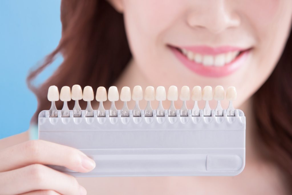 Are dental veneers worth the investment