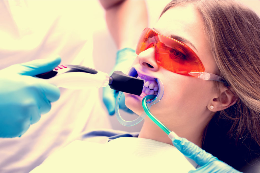 Guide for teeth whitening supporting