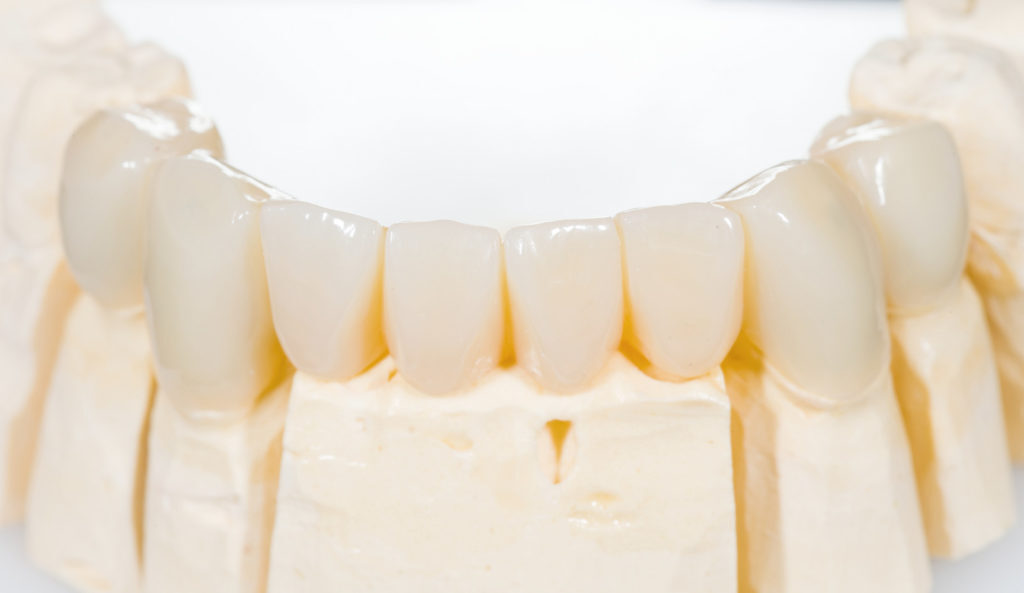 What you should know about dentures