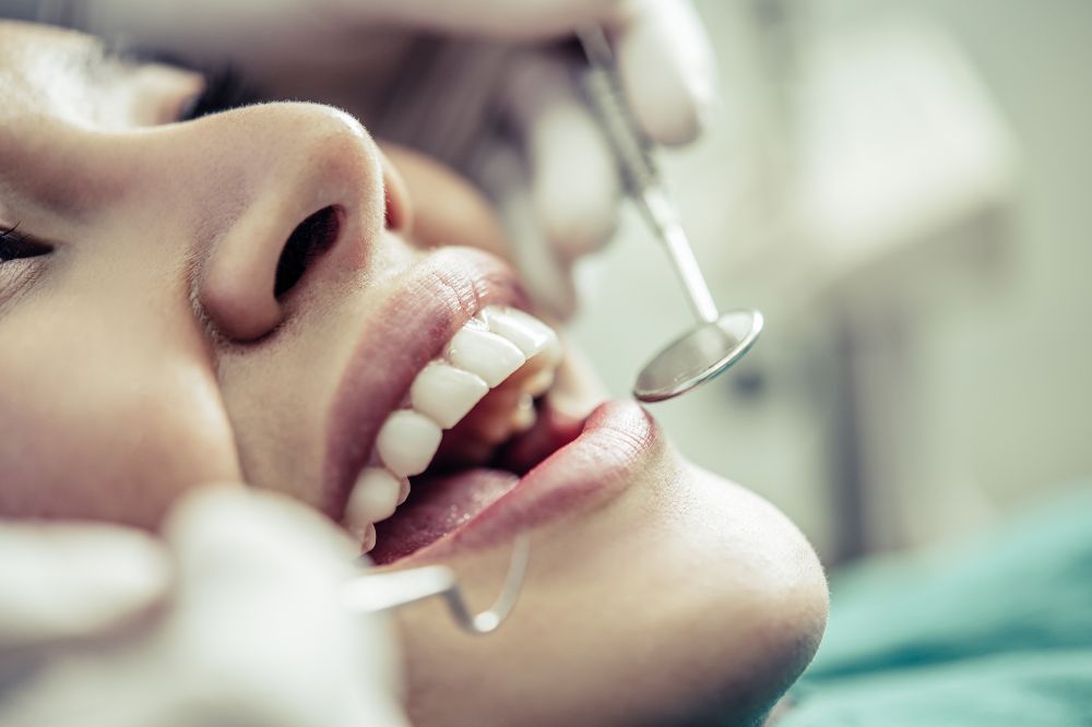 Is Dental Bonding Right for You? Everything You Need to Know