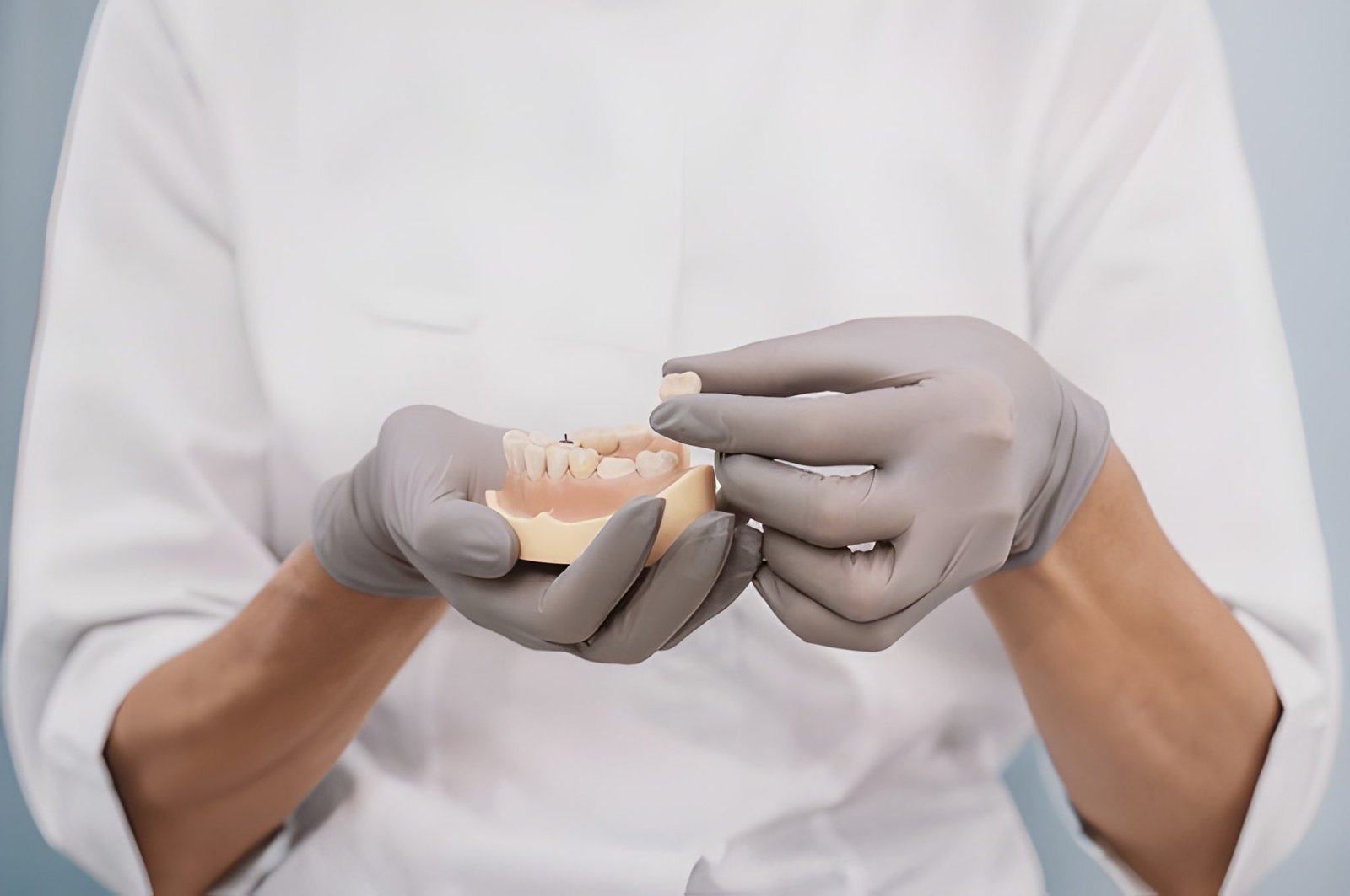 dental crowns in new westminster bc